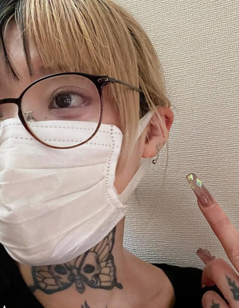 トチョニカペペ 整形 インスタグラム