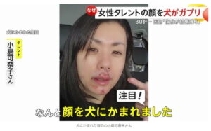 小島可奈子 犬 噛まれた FNN