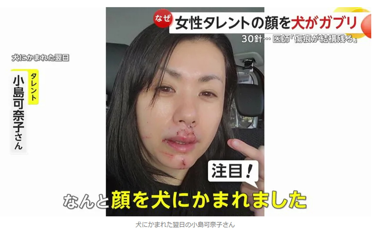 小島可奈子 犬 噛まれた FNN