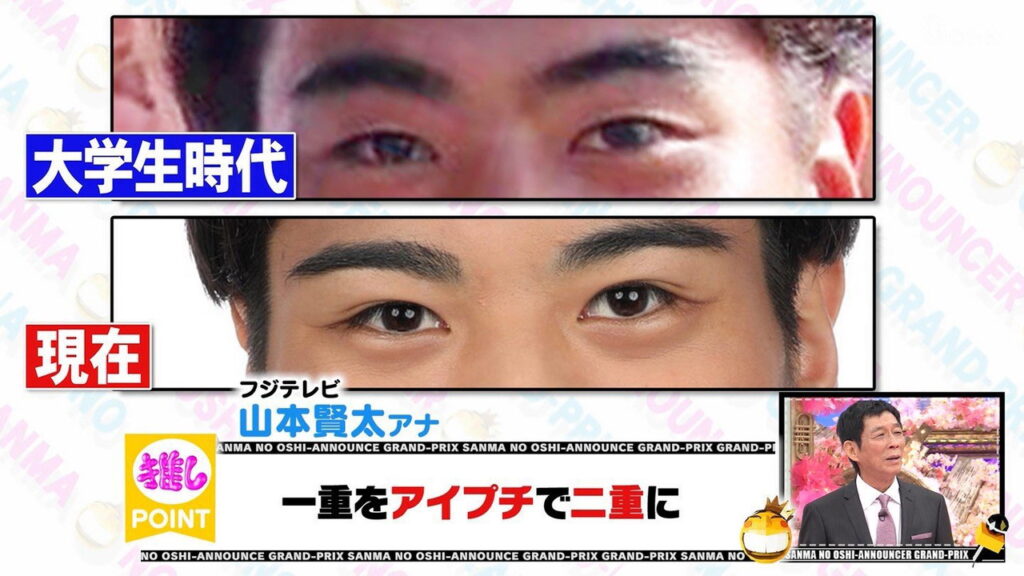 山本賢太アナ 整形 二重 FNS