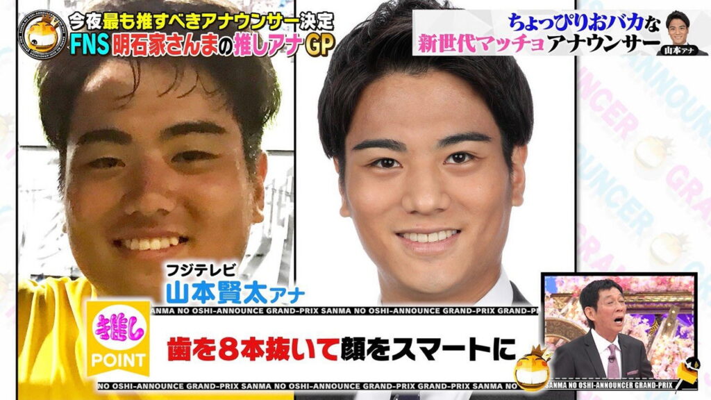 山本賢太アナ 整形 歯抜き FNS